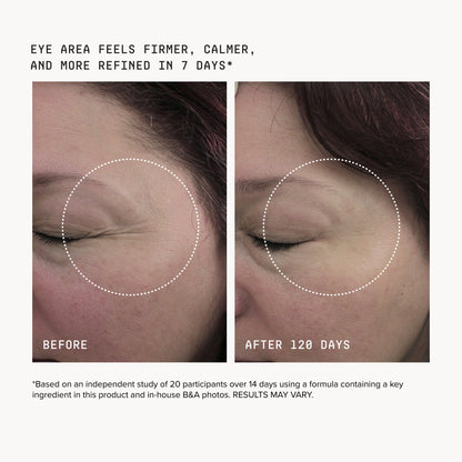 HPR Eye Cream