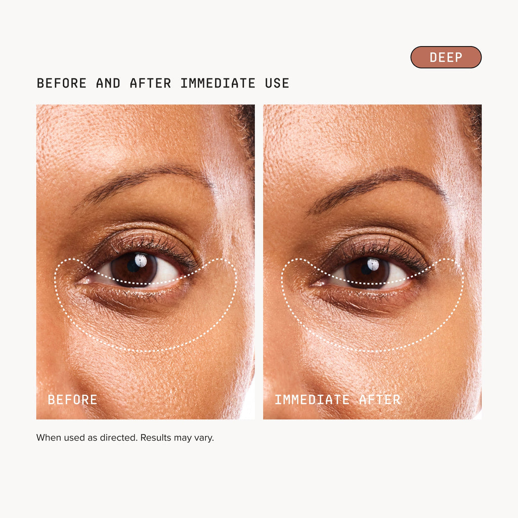 Dark Circles Bundle - Deep