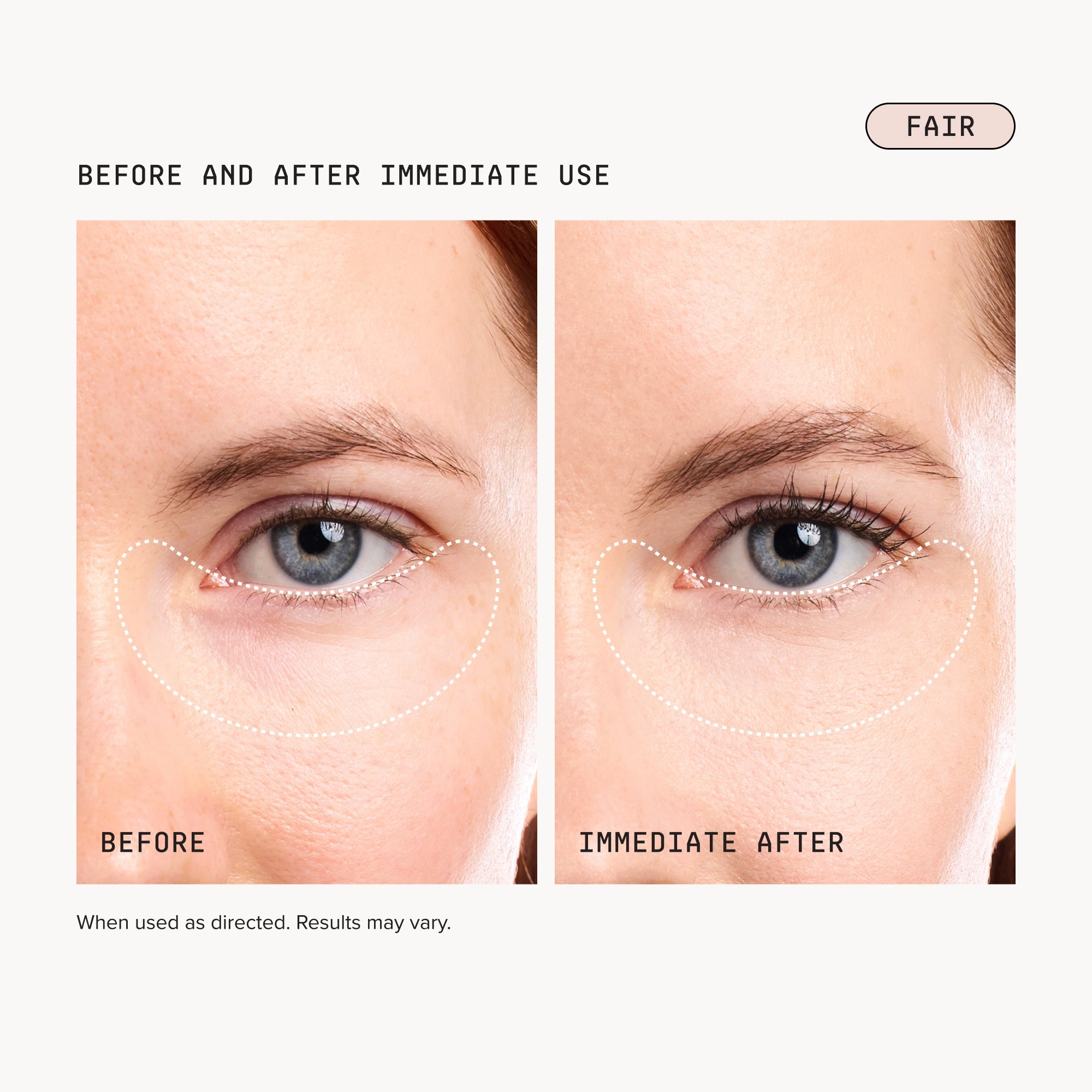Dark Circles Bundle - Fair