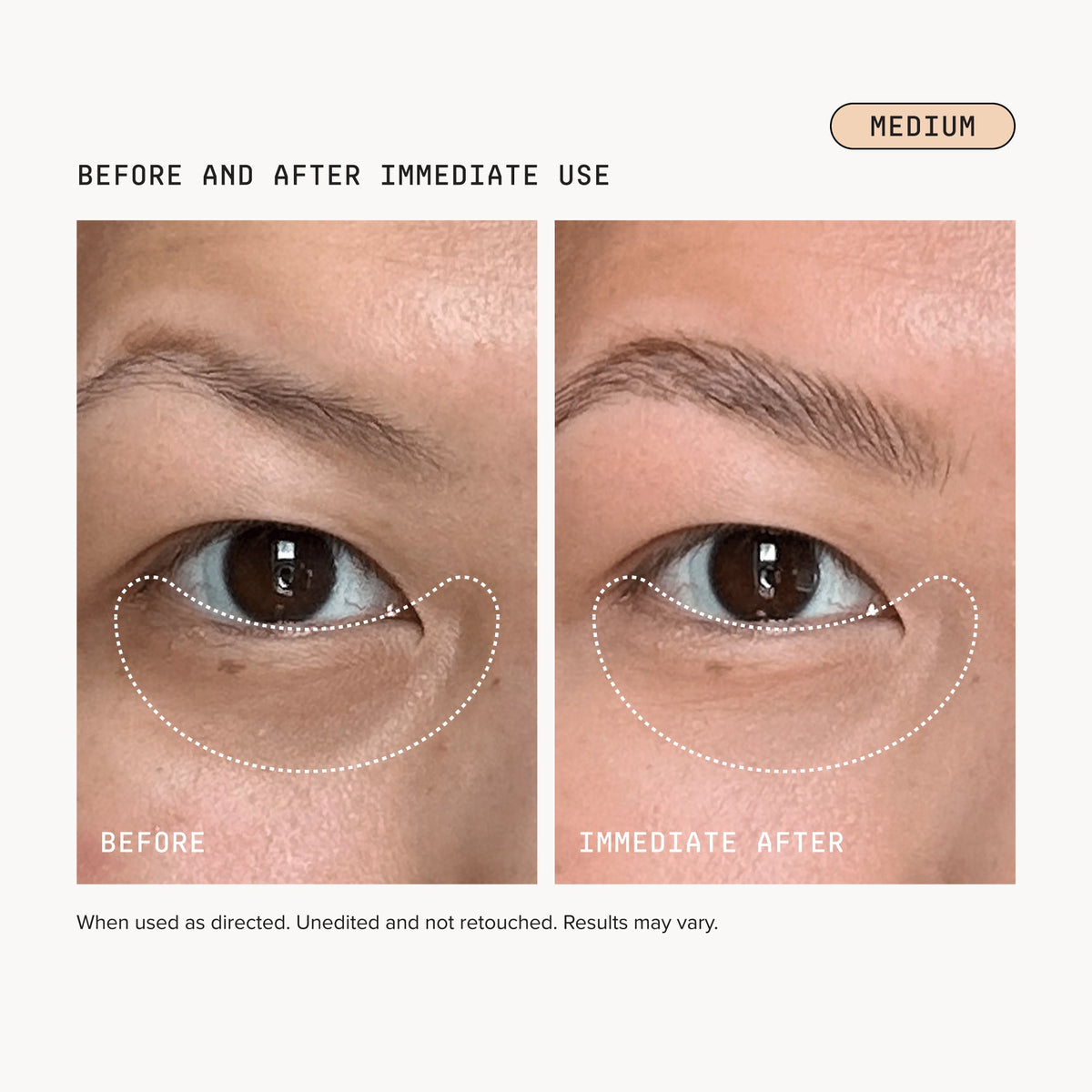 Dark Circles Bundle - Medium