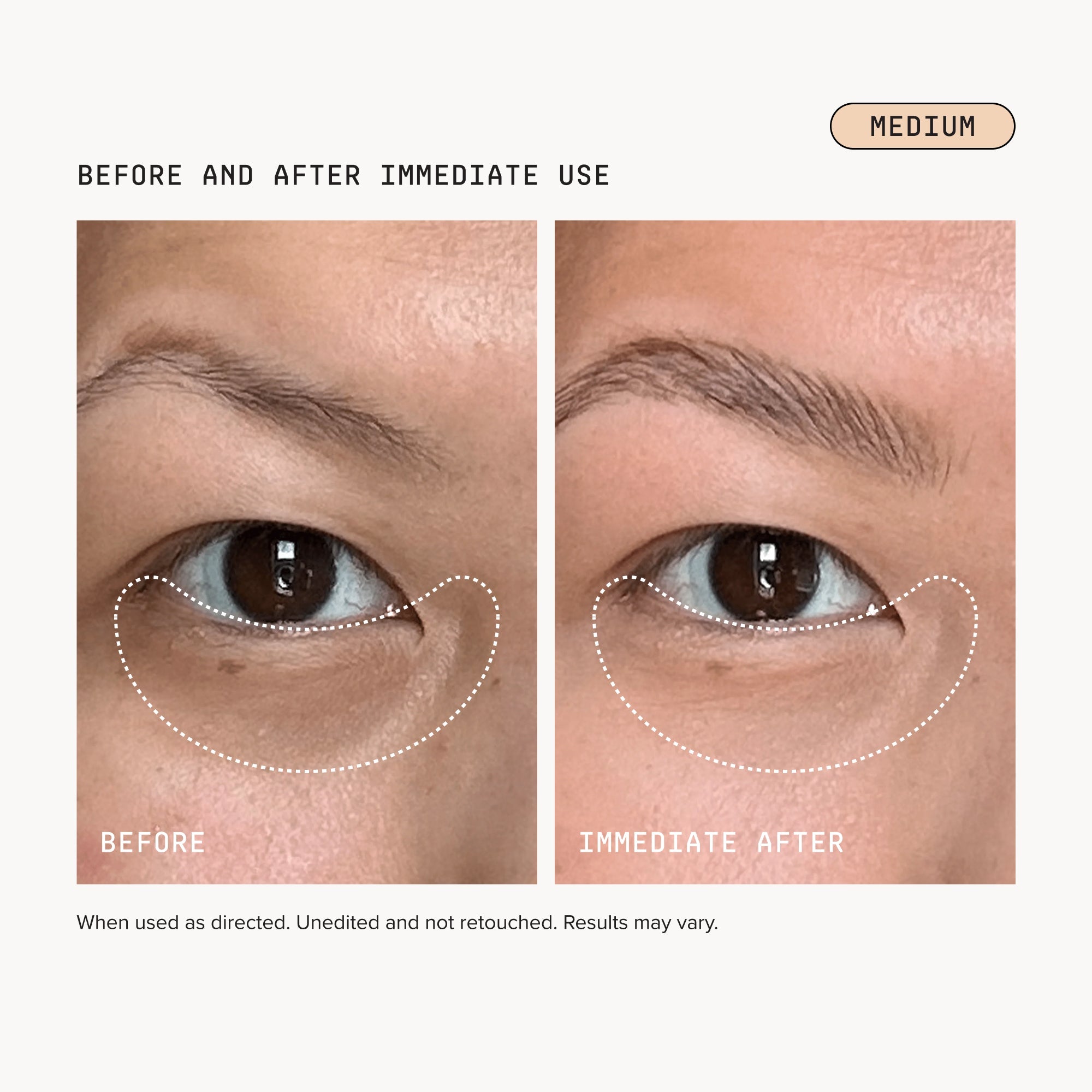 Dark Circles Bundle - Medium