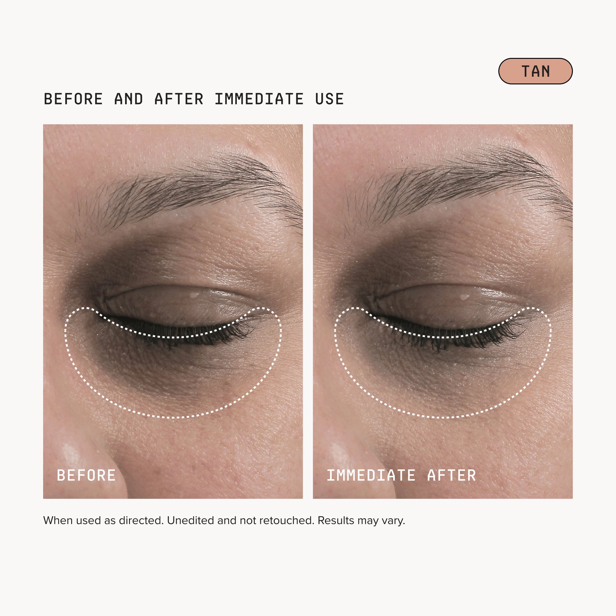 Dark Circles Bundle - Tan
