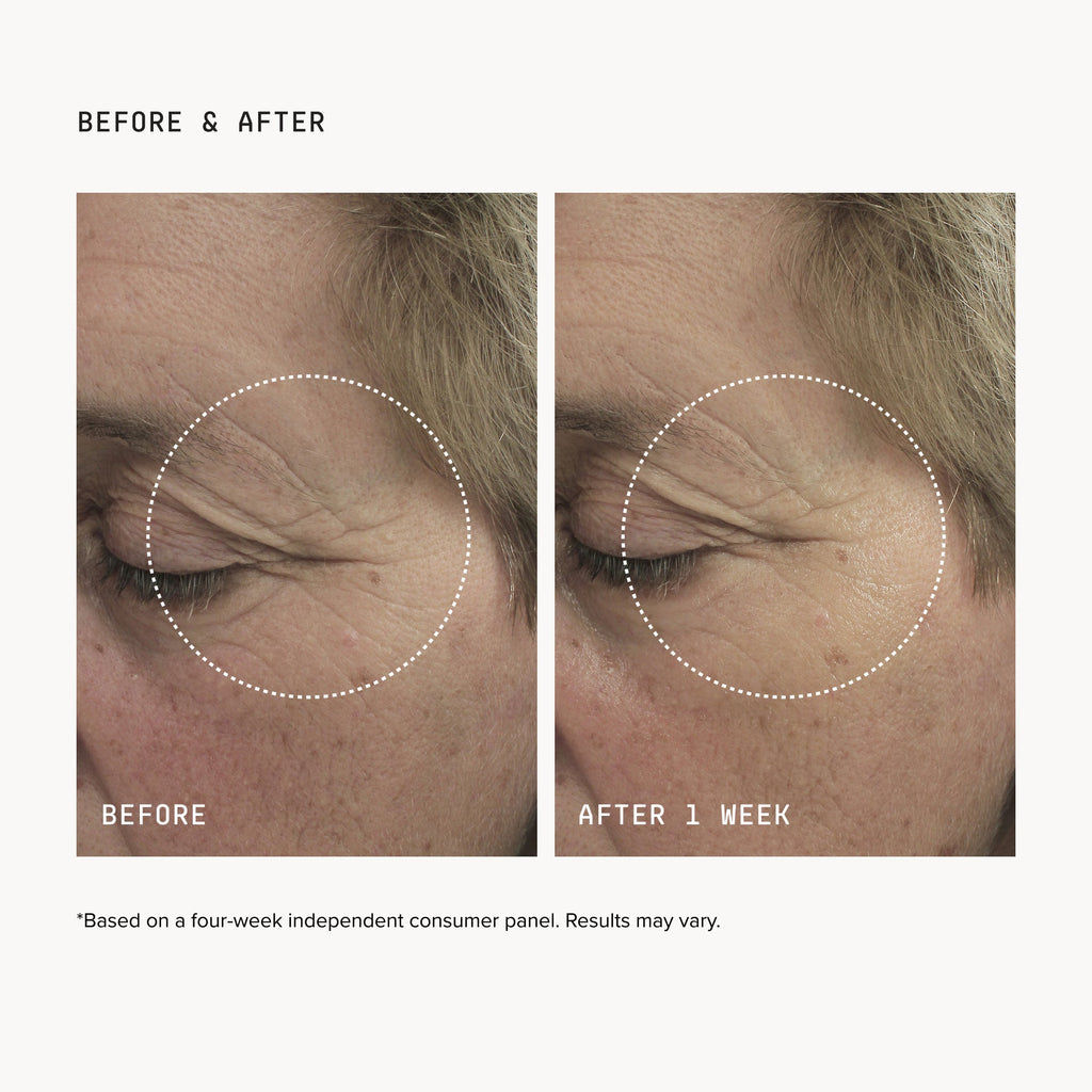 FacialRX™ Brightening Eye Masks