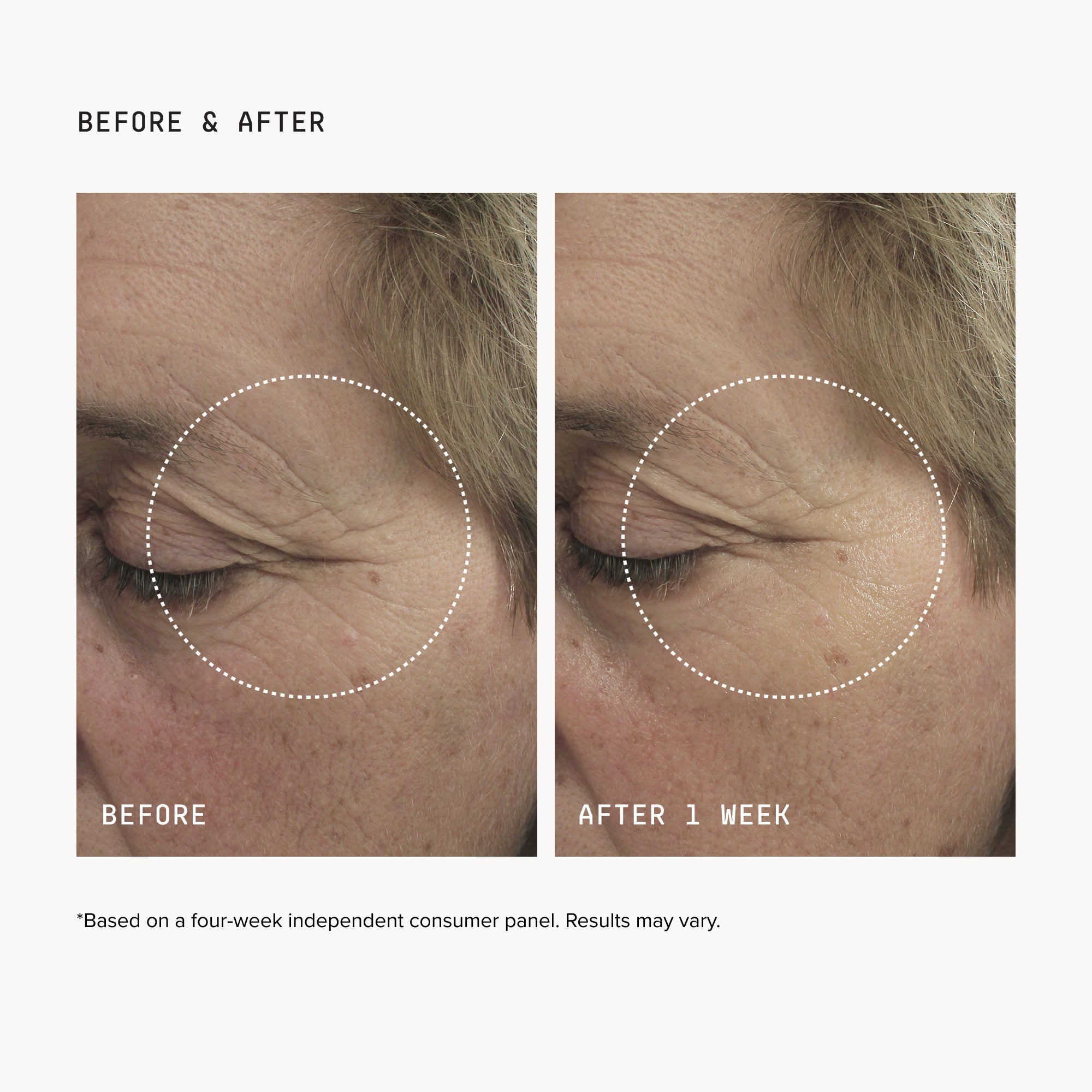 FacialRX™ Brightening Eye Masks