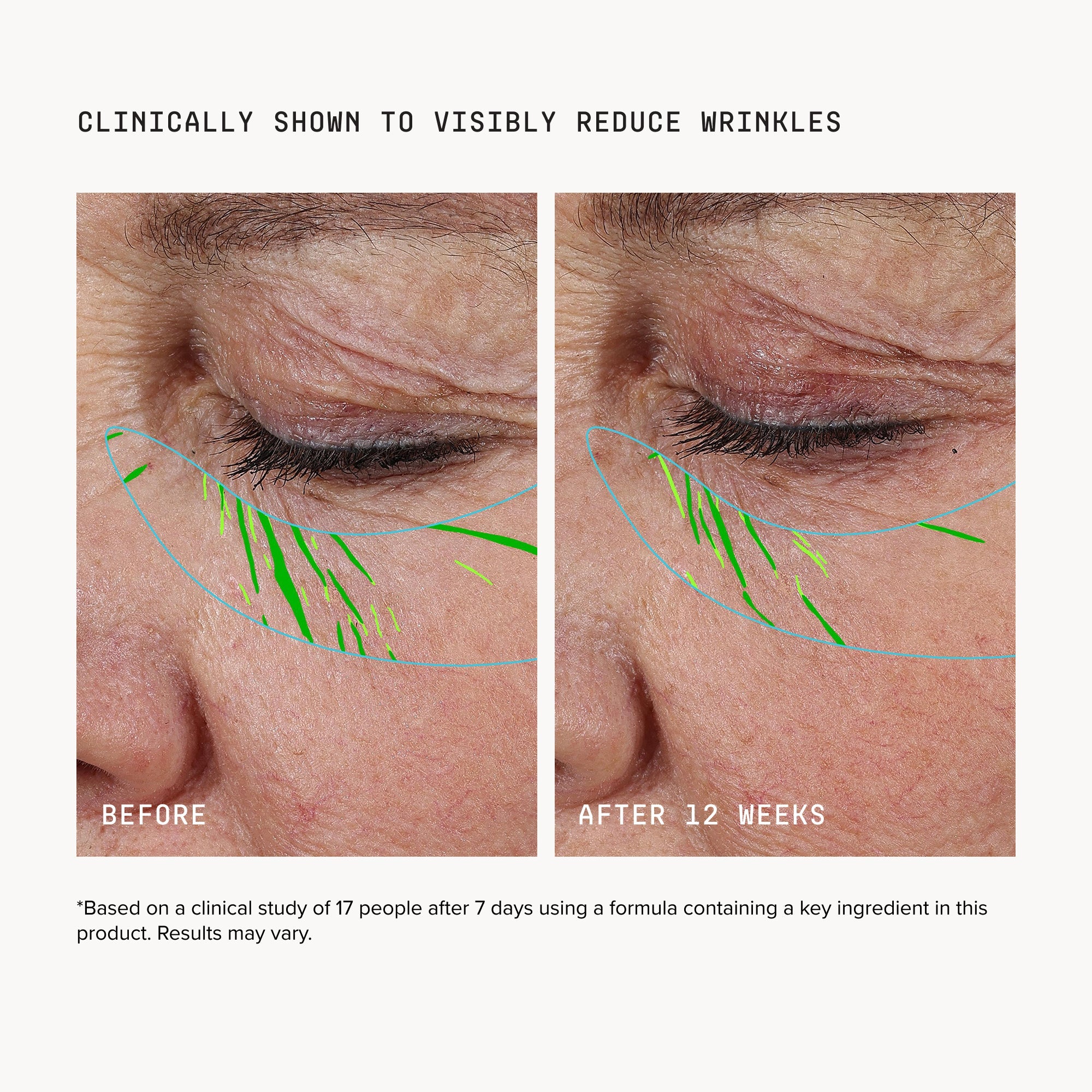 Needle-less® Growth Factor Serum