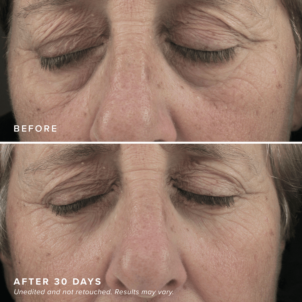 FacialRX™ Brightening Eye Masks