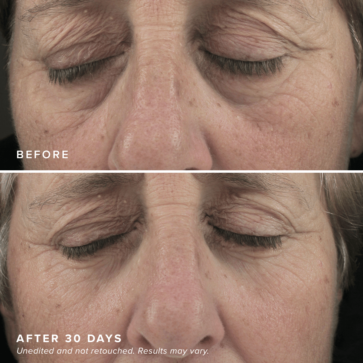 FacialRX™ Brightening Eye Masks