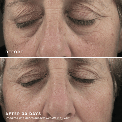 FacialRX™ Brightening Eye Masks
