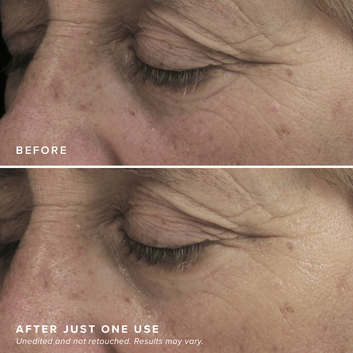 FacialRX™ Brightening Eye Masks