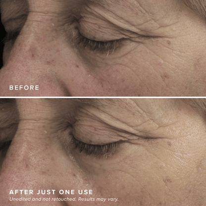 FacialRX™ Brightening Eye Masks